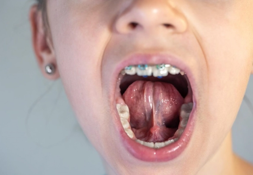 frenulum