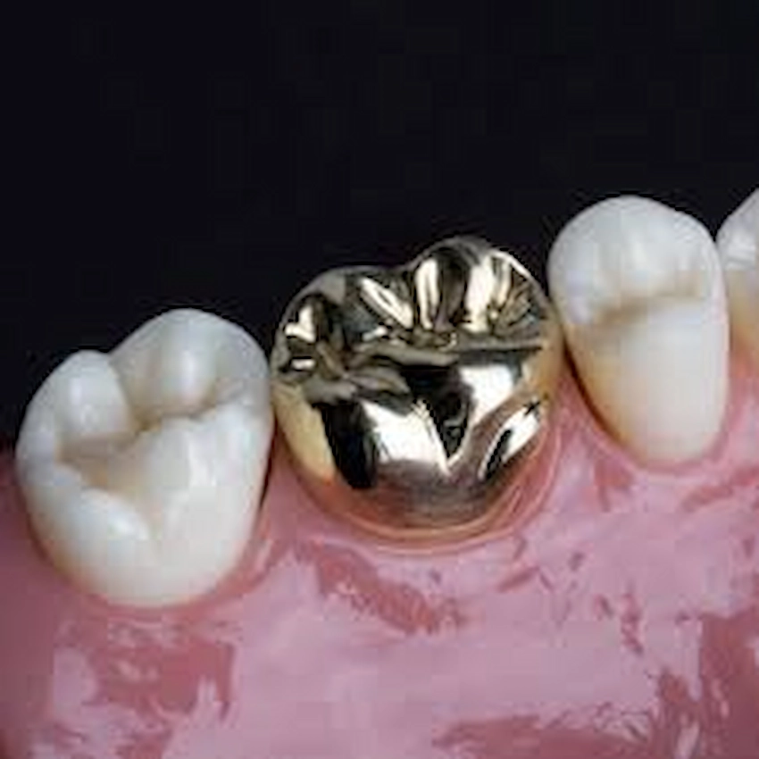 gold crown