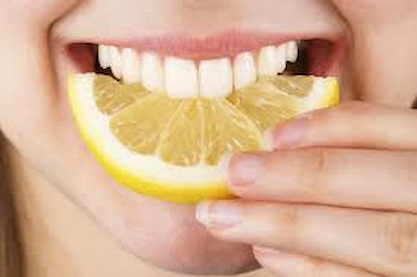 blanqueamiento dental