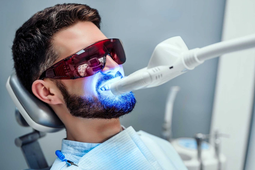 operación de blanqueamiento dental