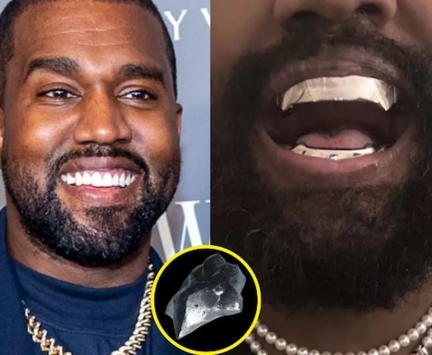 dientes de kanye west
