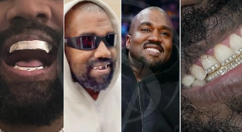 kanye west tooth