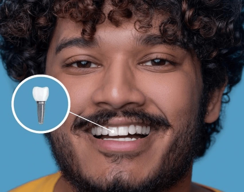 dental implant treatment