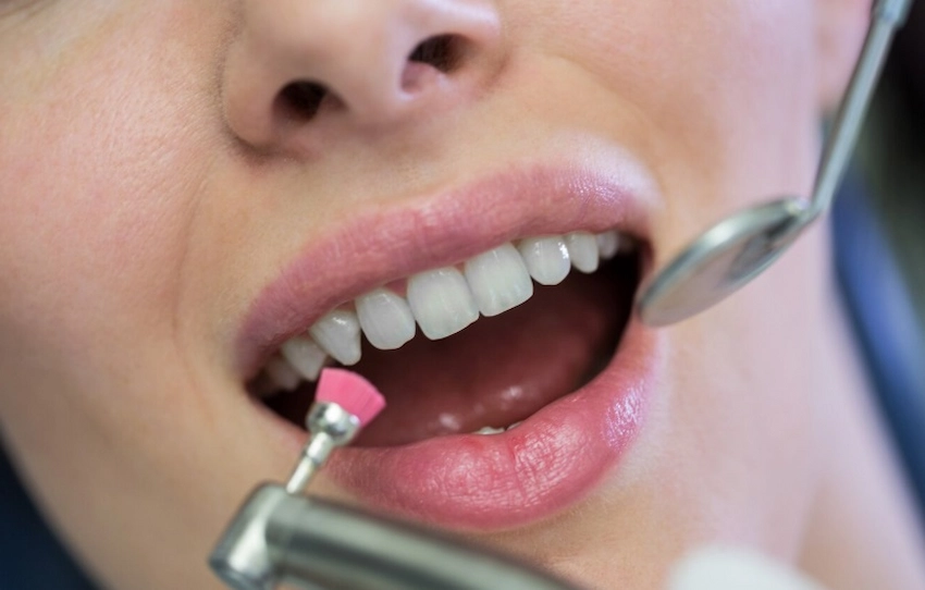 traitement de l'émail des dents