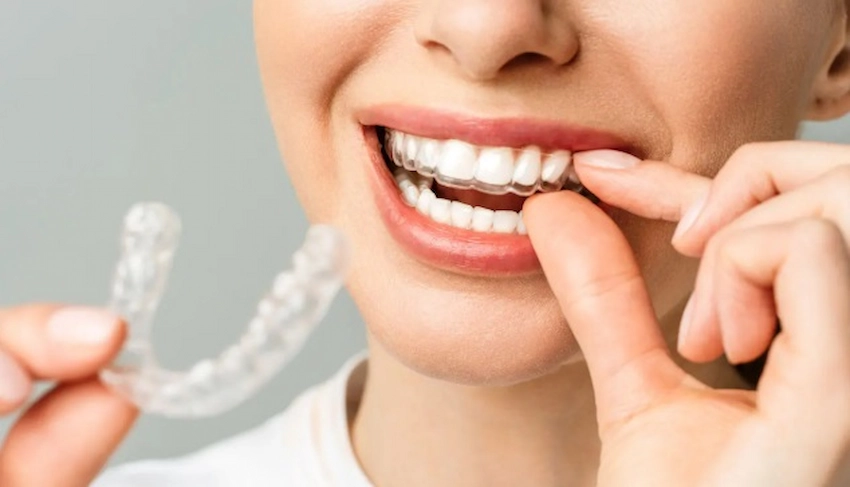 Pulizia del paradenti dentale