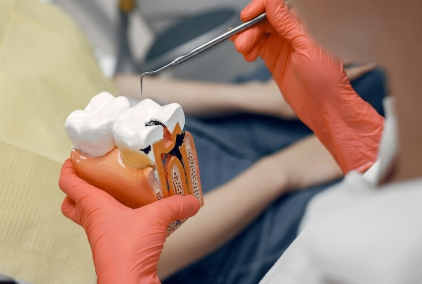 ¿cuánto tiempo toma un relleno dental?
