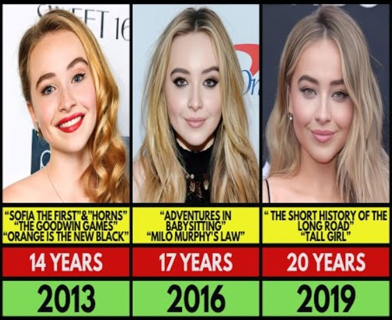 Sabrina-carpenter-new-theeth-new-dental-1