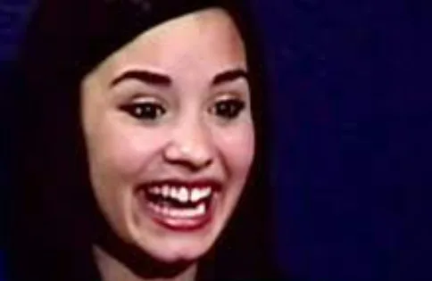 demi lovato teeth in 2007