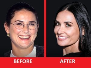 demi moore teeth before after demi moore teeth before after