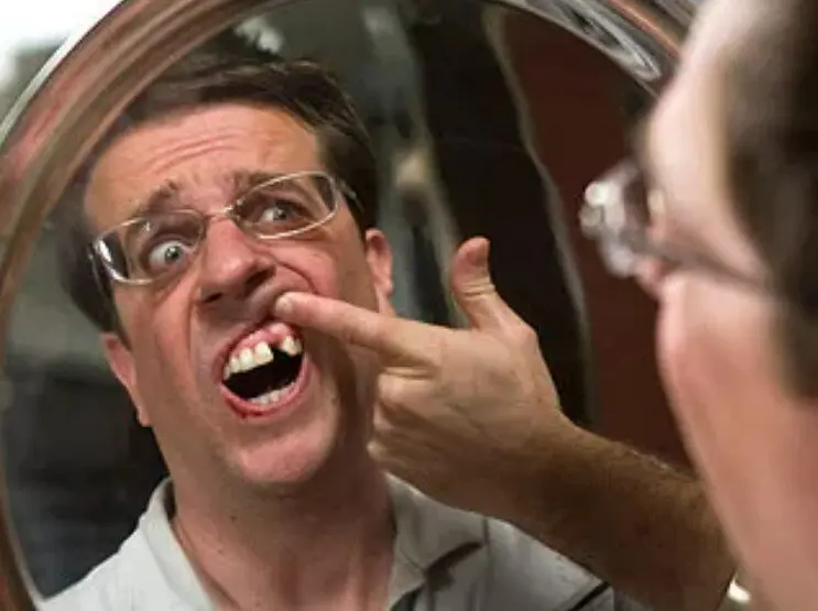 2009'da Ed Helms'in dişleri