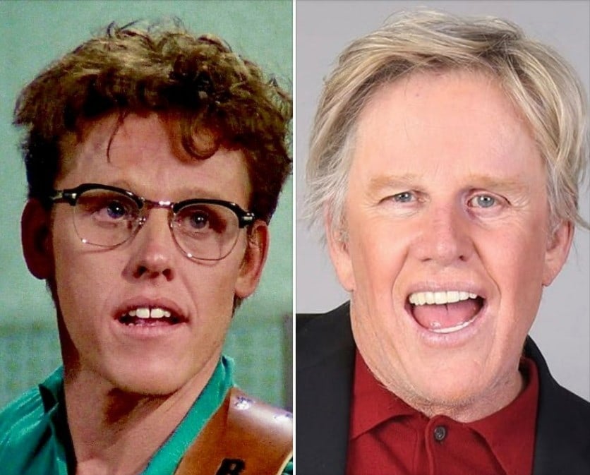 gary busey teeth before after