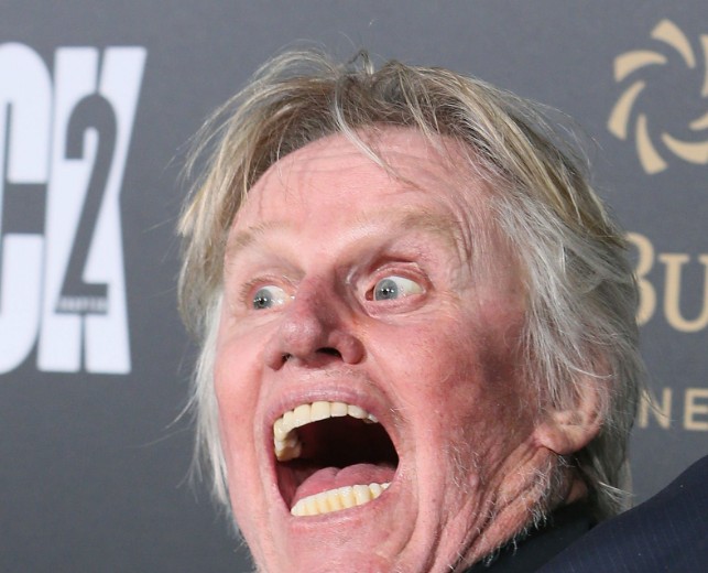 gary busey teeth in 2020