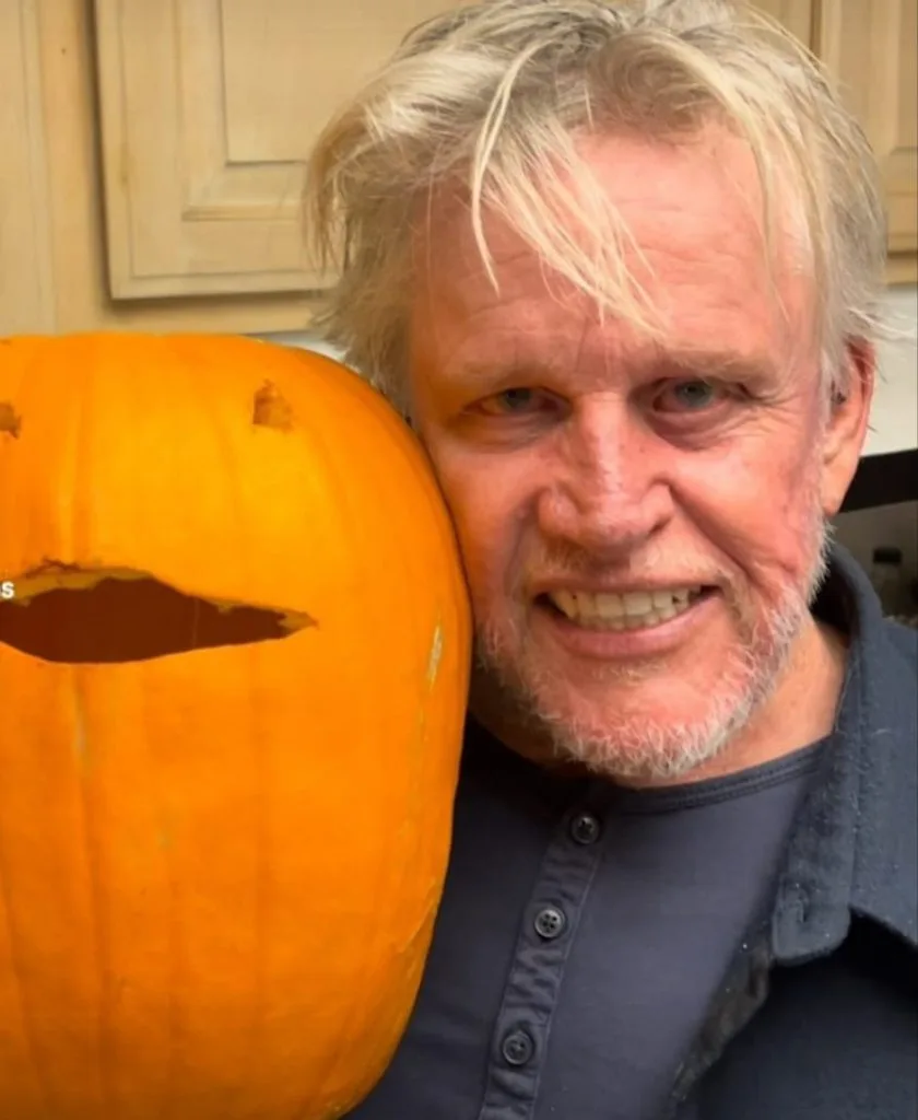 δόντια του Gary Busey το 2025