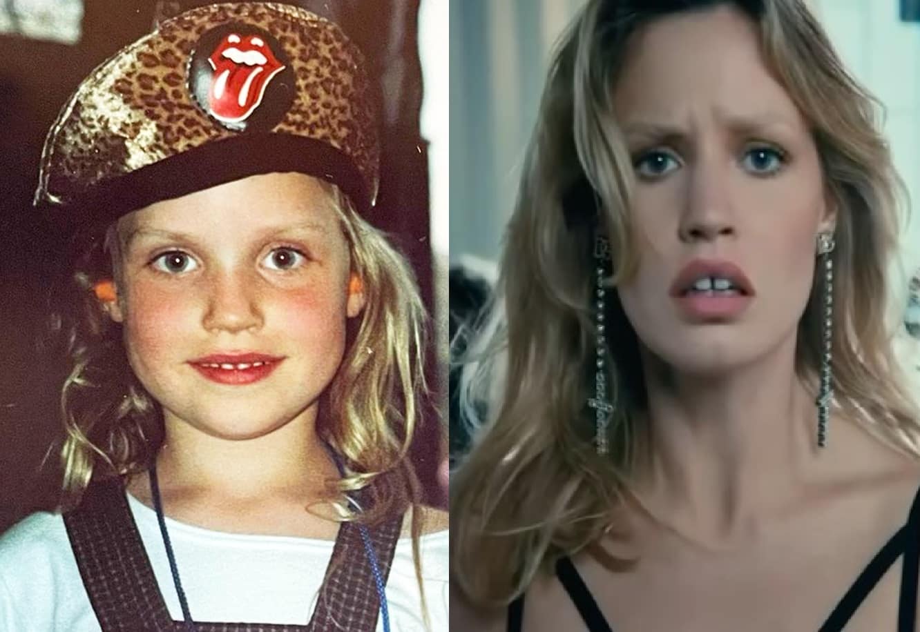 georgia may jagger teeth before and afters