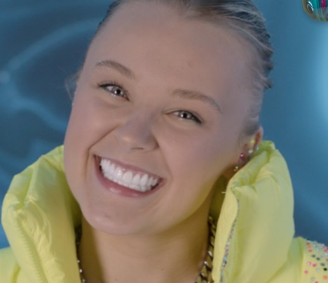 denti di jojo siwa nel 2025 dopo la procedura