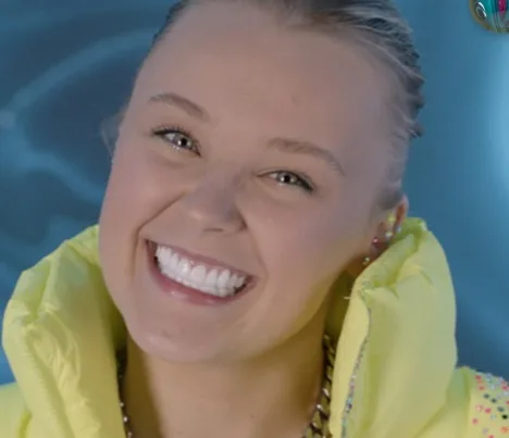 jojo siwa teeth in 2025 after procedure