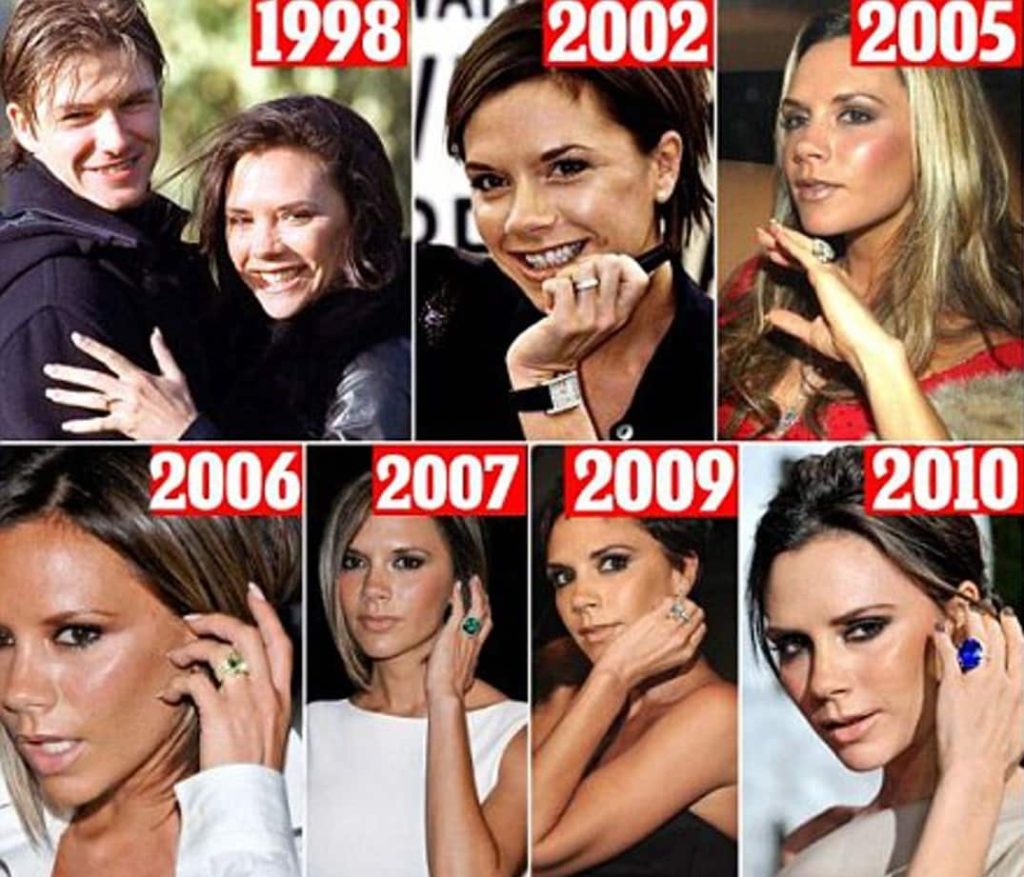 أسنان فكتوريا بيكهام في 2005