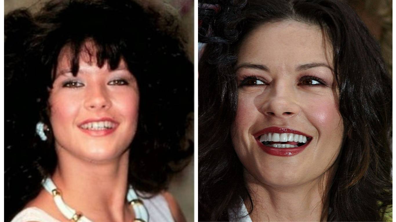catherine zeta jones before after