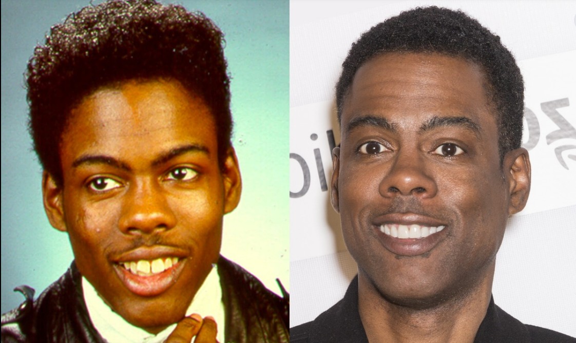 chris rock teeth before after
