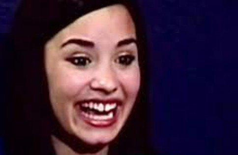 demi lovato teeth in 2007