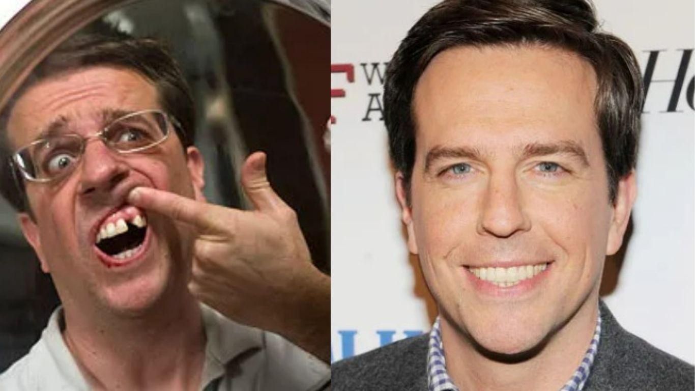 ed helms teeth before after