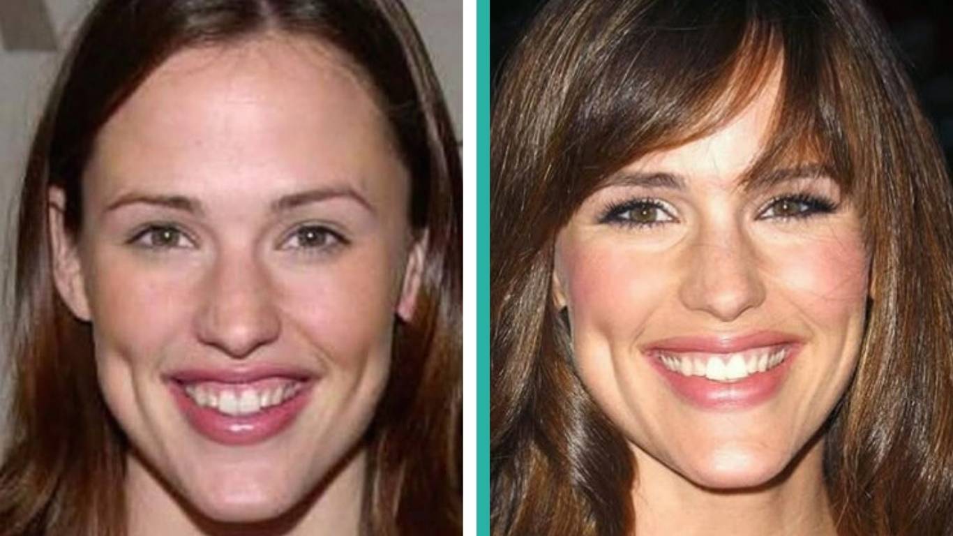 jennifer garner before after