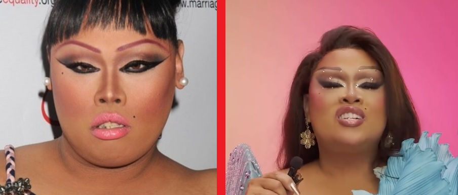 jiggly caliente teeth before and afters