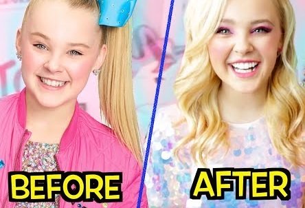 jojo siwa teeth before after