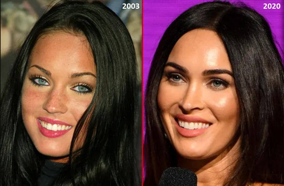 dientes de megan fox en 2003