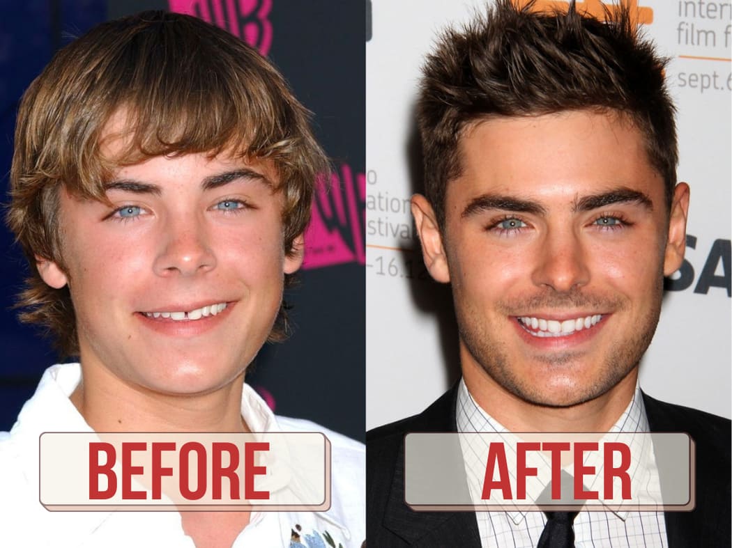 zac efron before after(2000 2025)
