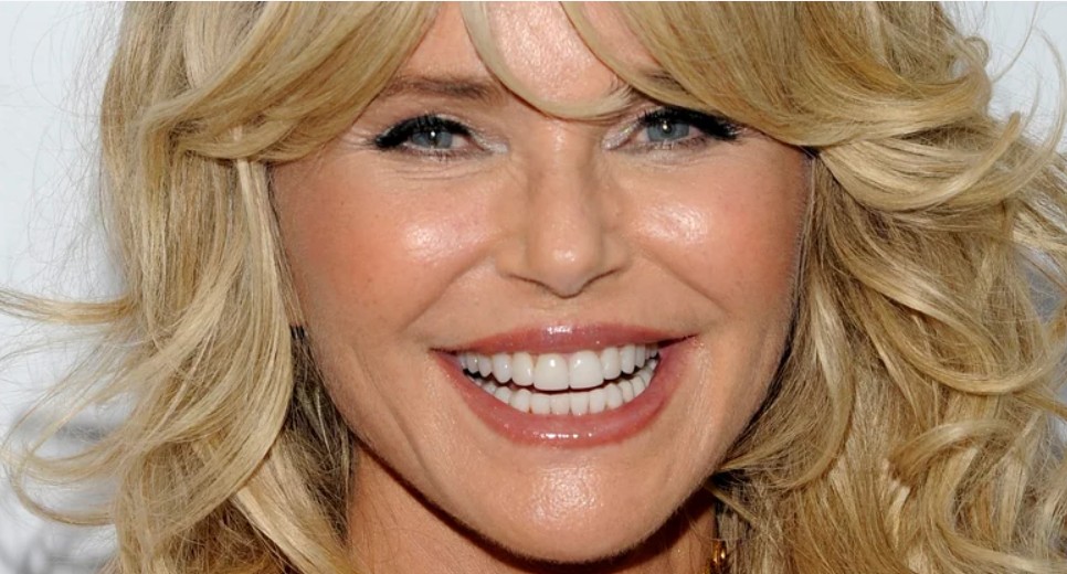 christie brinkley teeth in 2021