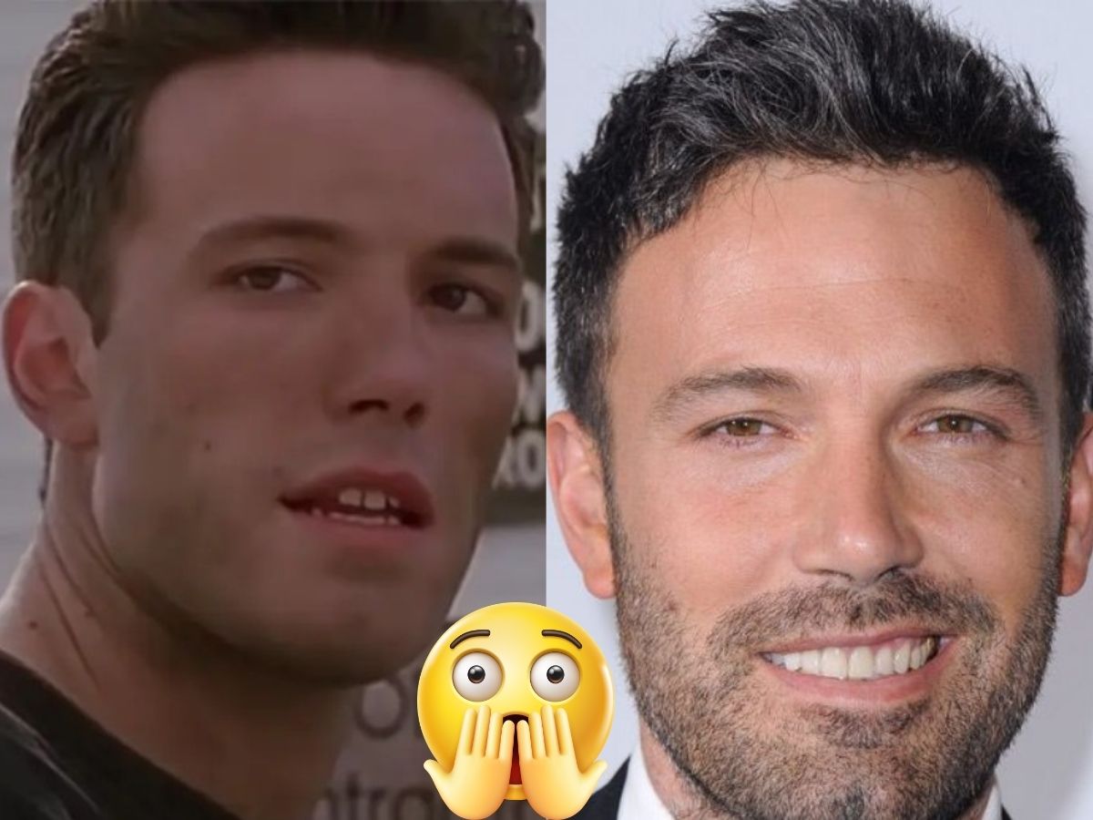 Ben Affleck-teeth-before-after