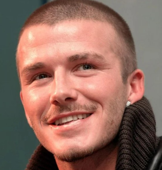 dents de david beckham en 2001