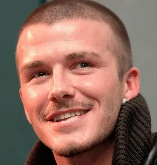 δόντια του David Beckham το 2001