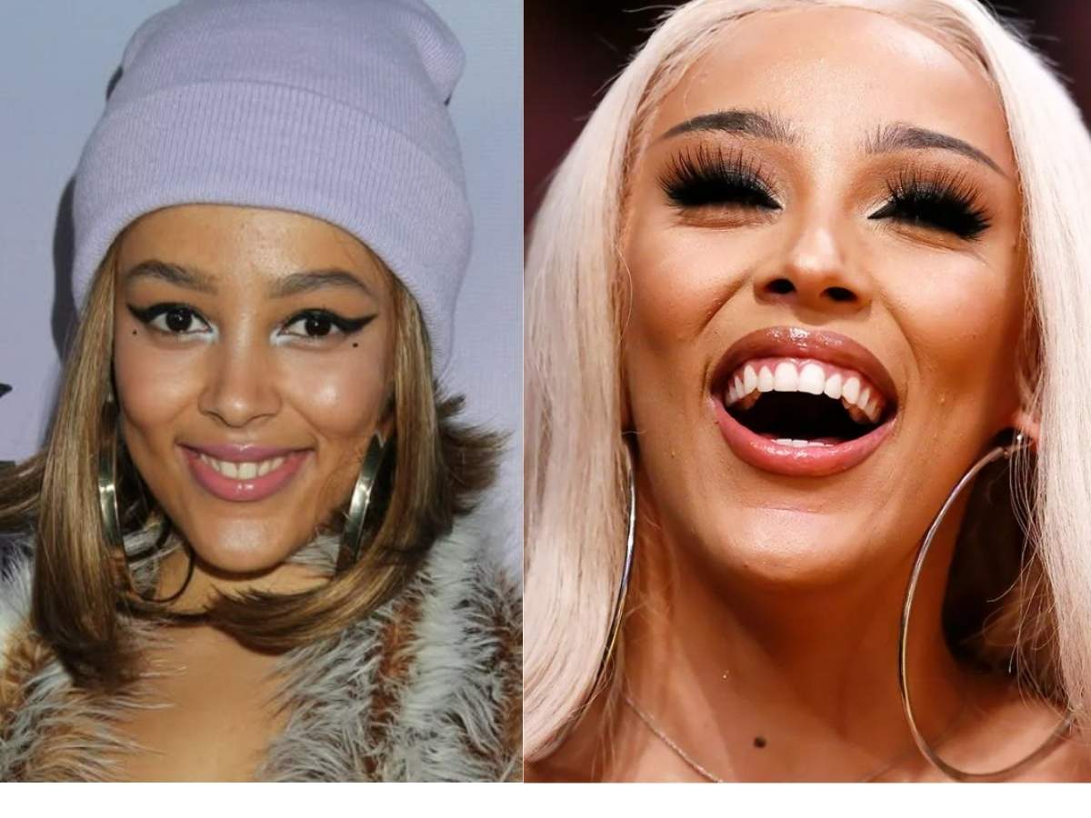 doja cat teeth before after