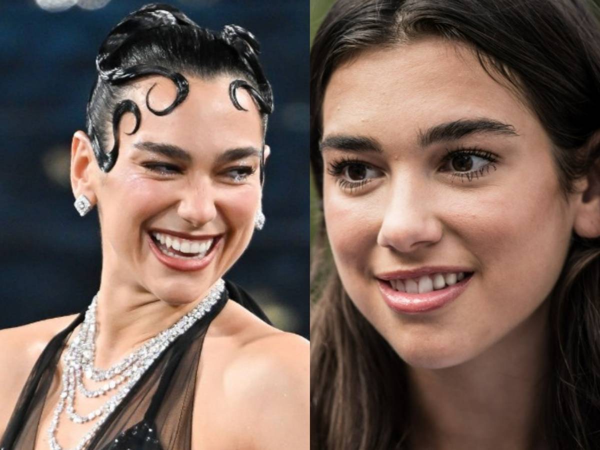 dua lipa teeth before after