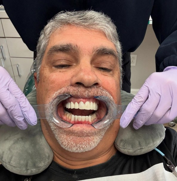 gary dell'abate teeth
