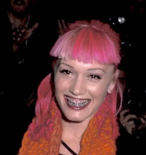 I denti di Gwen Stefani nel 1999