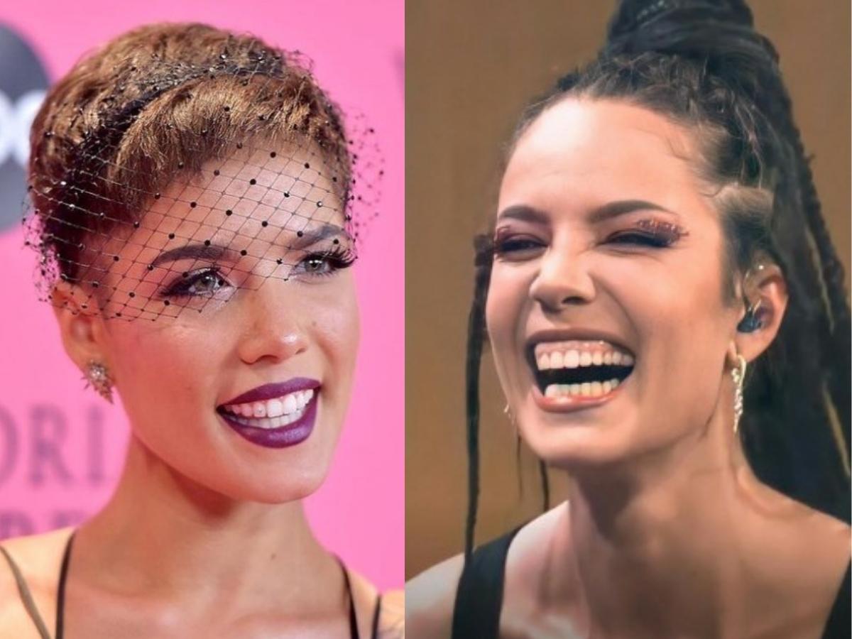 halsey teeth before after