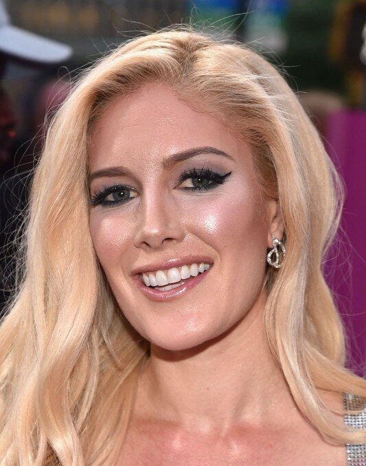 heidi montag teeth in 2018