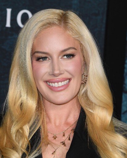 heidi montag teeth in 2025
