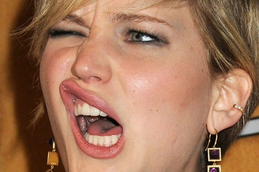 jennifer lawrence teeth