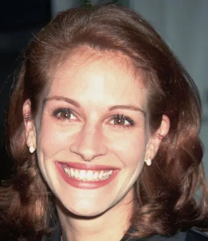 δόντια julia roberts το 1996