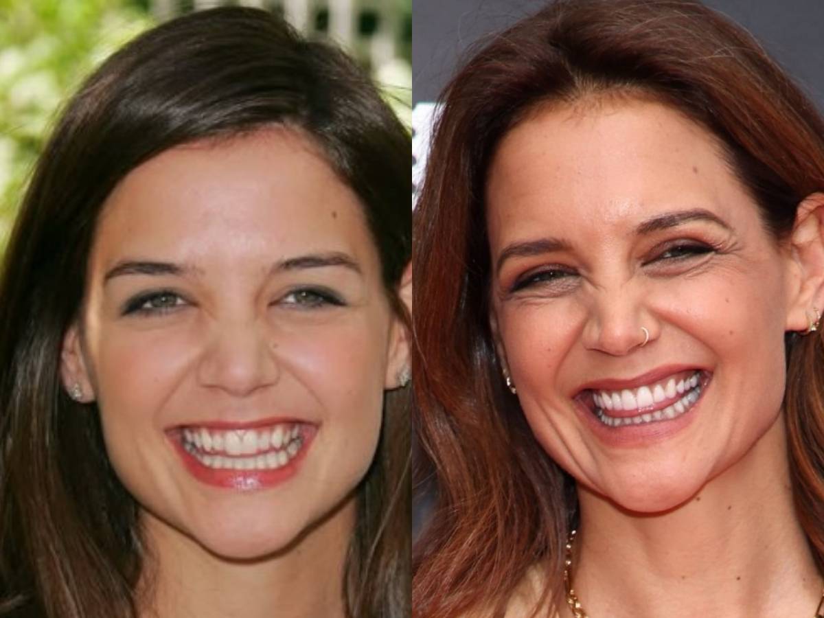 katie holmes teeth before after