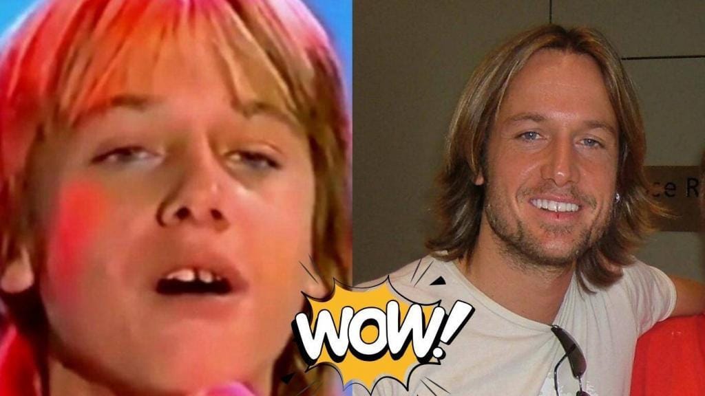 keith urban teeth before after keith urban teeth before after