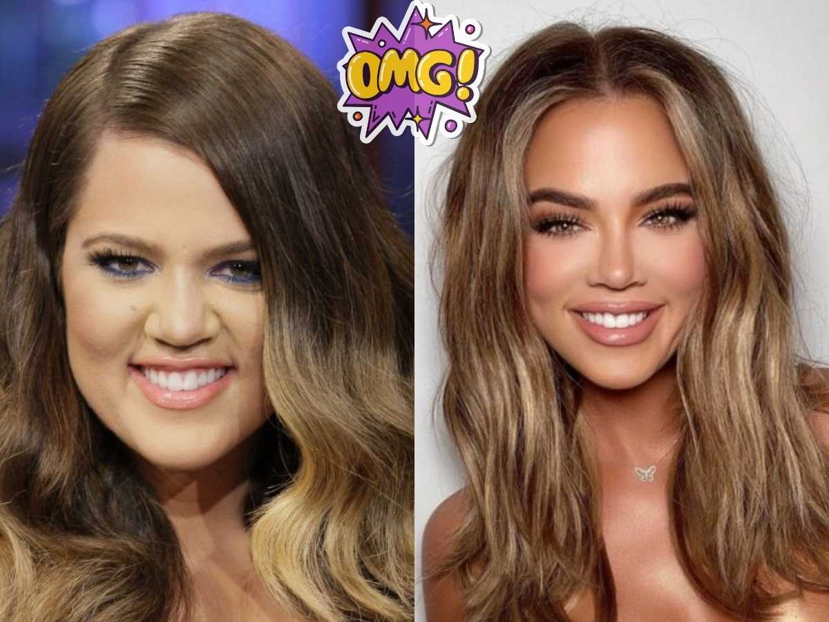 khloe kardashian teeth before after