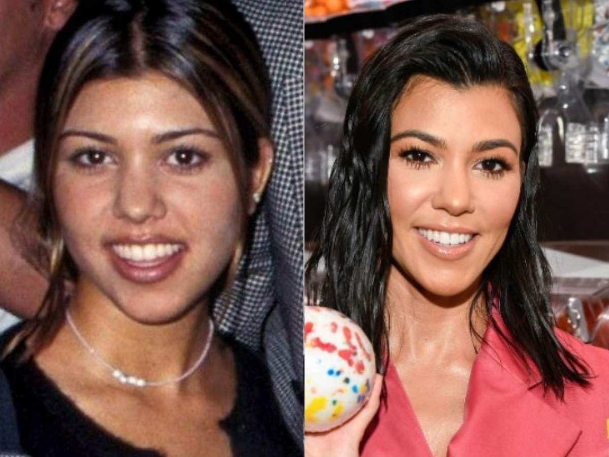 kourtney kardashian teeth before after
