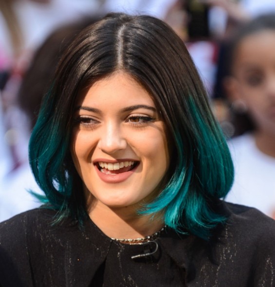 kylie jenner teeth in 2014