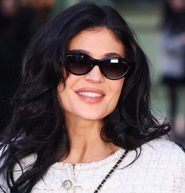 kylie jenner teeth in 2025