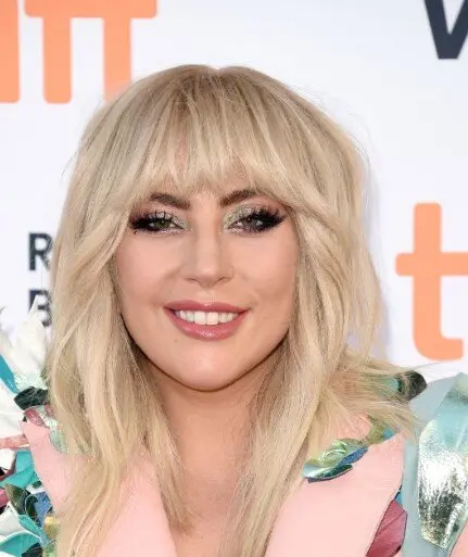 lady gaga teeth in 2017